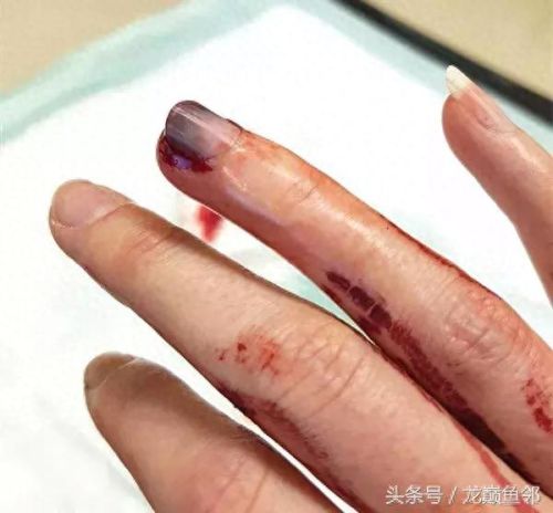 皮皮虾宝宝上什么技能(皮皮虾小孩特效)