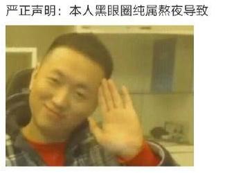 本人黑眼圈声明(黑眼圈太重怎么办)插图6